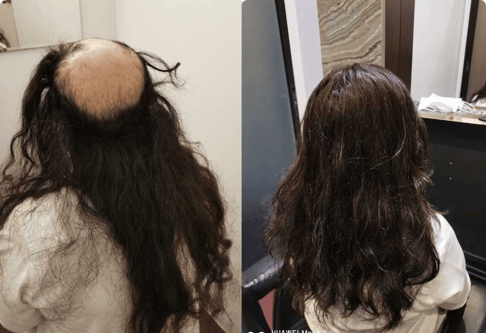 Hairspec Singapore