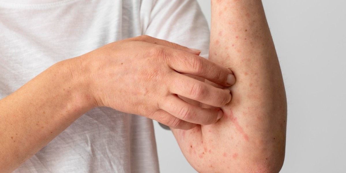 Are You Suffering from Pollen Allergies This Season?