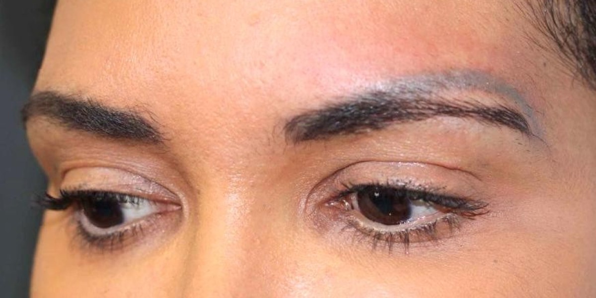 Best Clinics for Eyebrow Tattoo Removal in London: Top 10 Reviewed