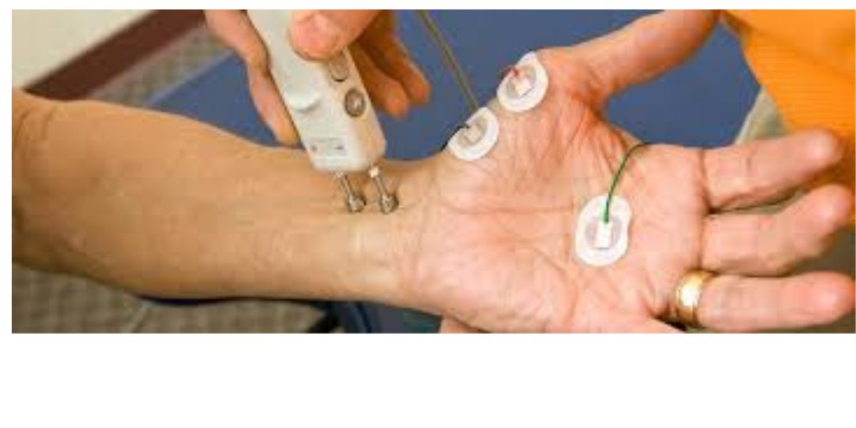 Understanding the Nerve Conduction Velocity Test: A Complete Guide for Patients in Bangalore