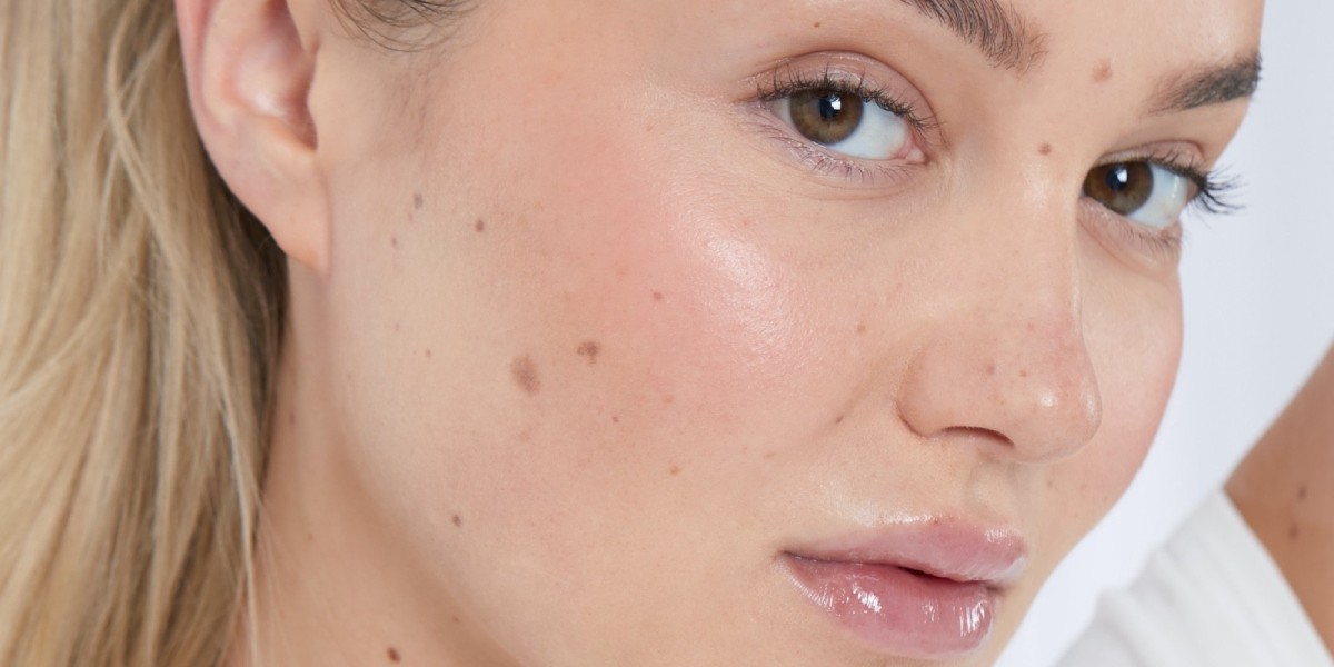 Dubai Skin Whitening: What Experts Recommend