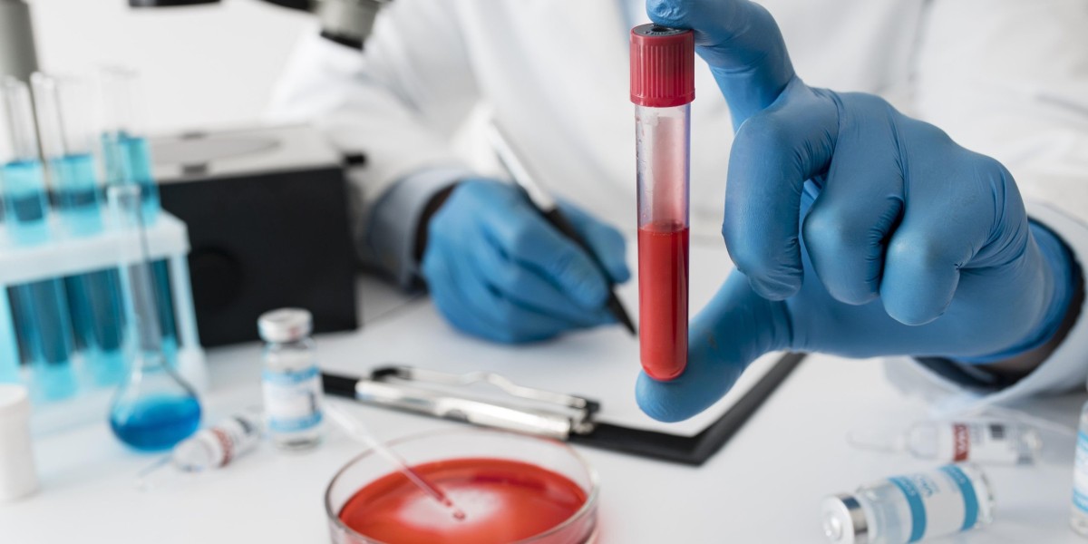 Your Complete Guide to Booking a Blood Test in Bangalore with Ecotown