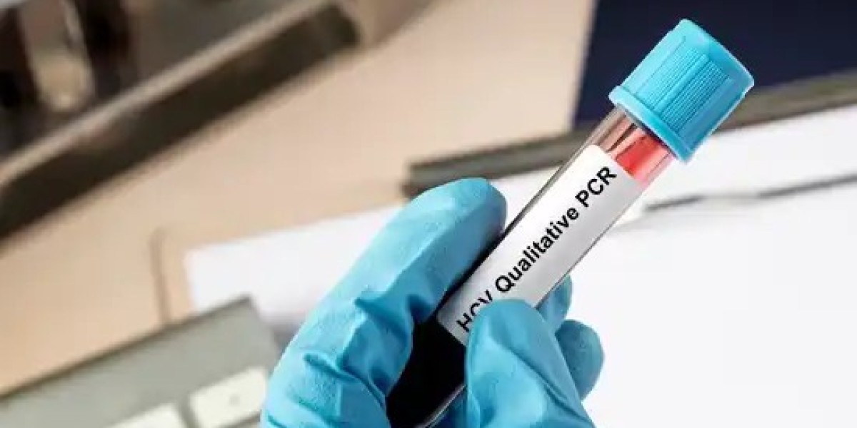 How Long Does a Hepatitis C Test Take?