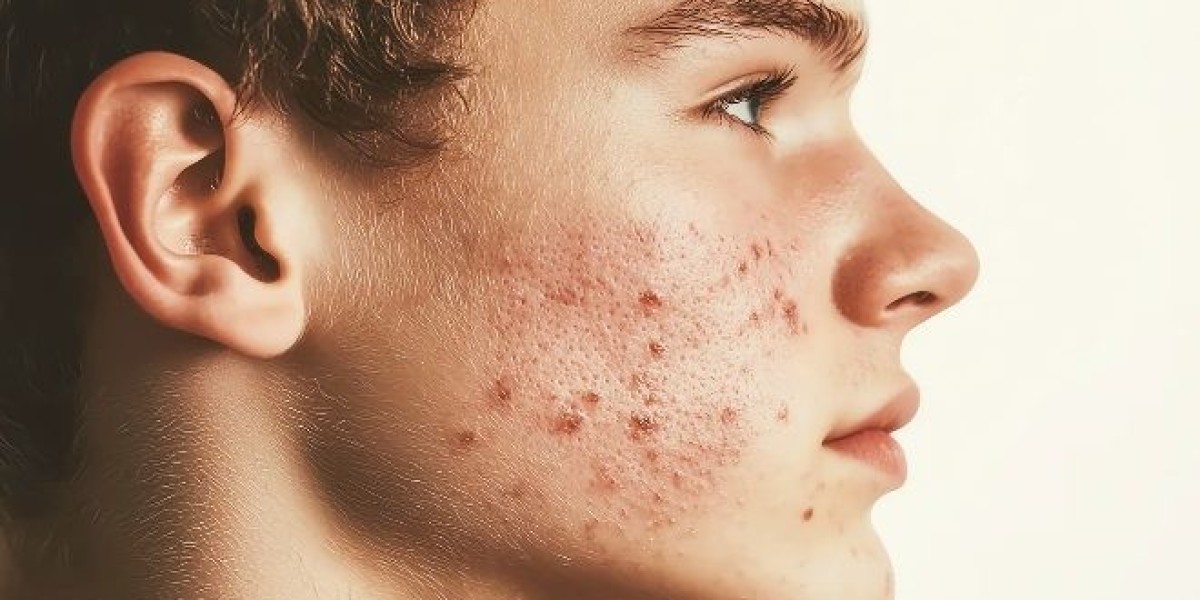 Get Glowing Skin Fast With Skin Whitening Treatment Solutions