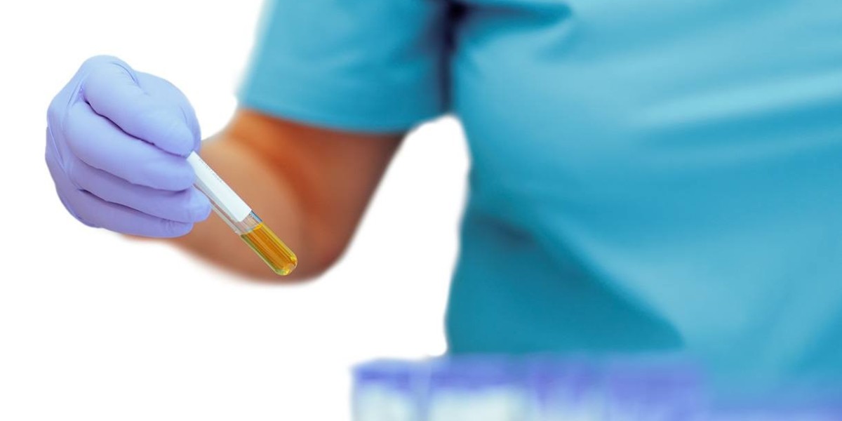 What Makes Mycoplasma Testing Different from Bacterial Tests?