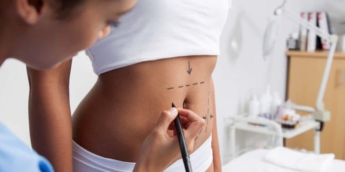 Tummy Tuck in Dubai to Reveal a Clean, Refined Midsection Look