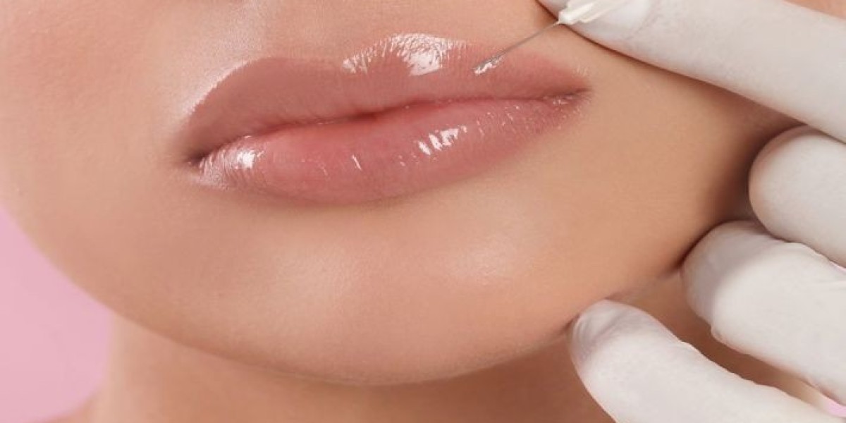 What Are the Benefits of Russian Lip Fillers?