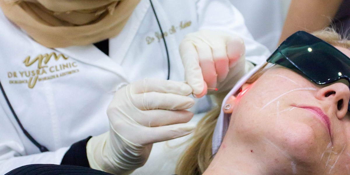 Endolift Nottingham: Lift, Tighten and Contour Without Surgery