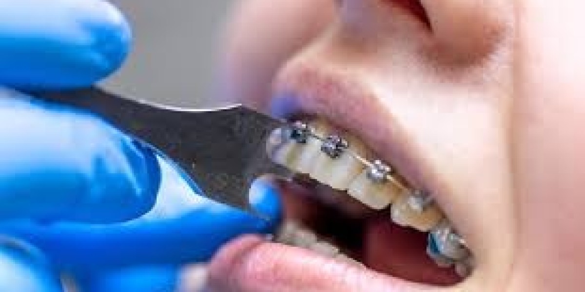 Cosmetic Dentist in Bangalore – Transform Your Smile with Anew Cosmetic Clinic