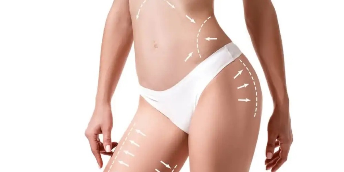 Liposuction Myths Debunked: What You Should Know