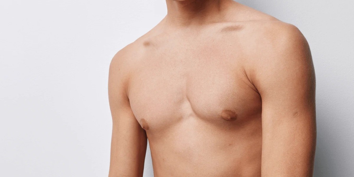Can Gynecomastia in Dubai Be Successfully Treated?