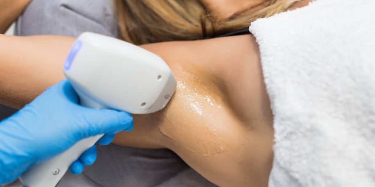 What Questions to Ask During Laser Hair Removal Consultation?
