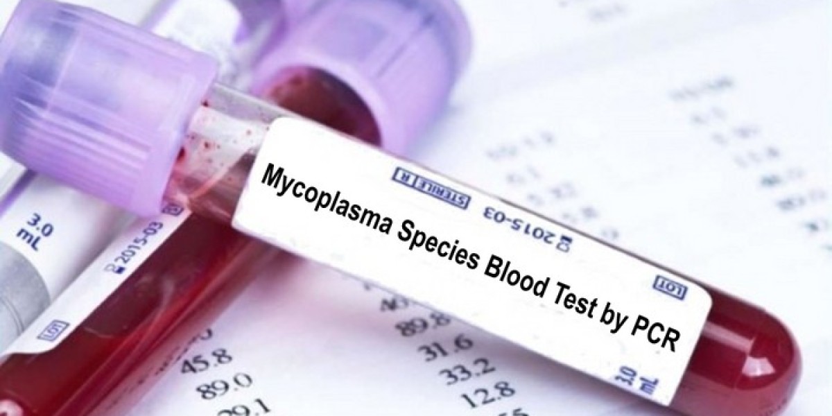 How Accurate Is a Mycoplasma Test?