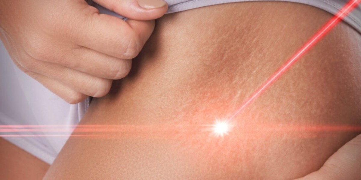 What Types of Scars Can Be Treated Successfully