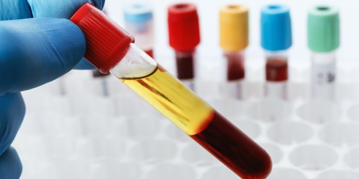 What Is the Difference Between HCV Antibody and RNA Tests?