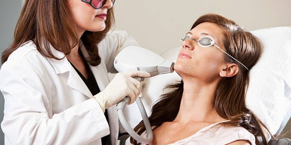 Laser Hair Removal for Smooth Skin and Long-Lasting Confidence