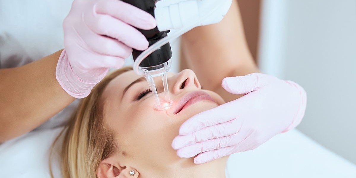 When Doctors Suggest Fractional CO2 Laser Treatment