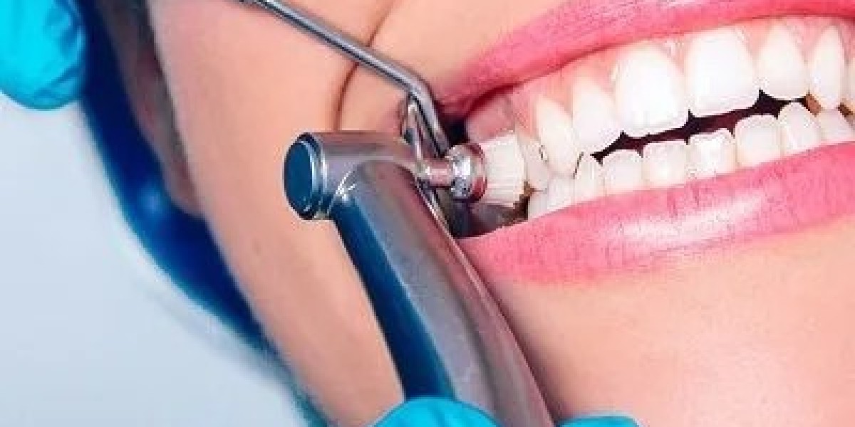 A Simple Guide to Teeth Whitening Cost in Dubai