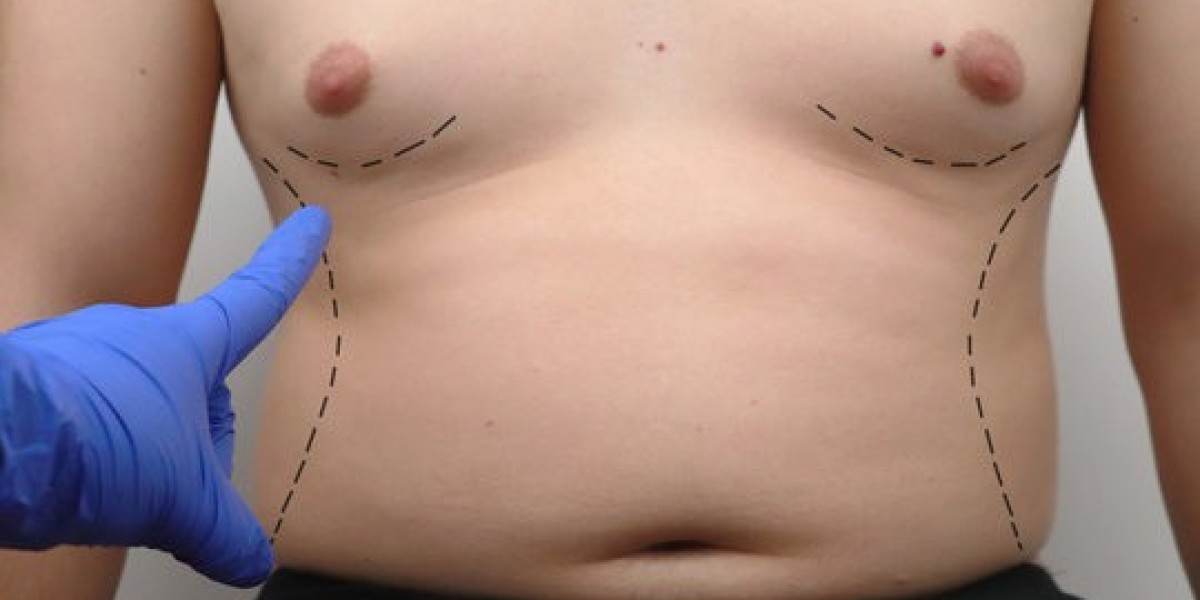 Transform Your Chest, Transform Your Life