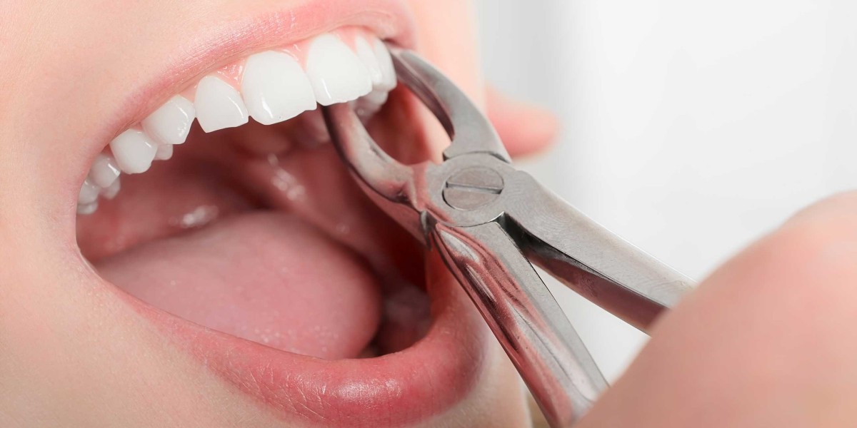 Is Tooth Extraction Cost in Dubai Rising?