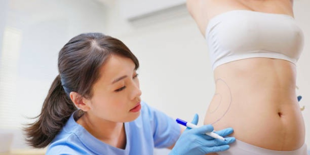 Power-Assisted Liposuction Procedure in Riyadh