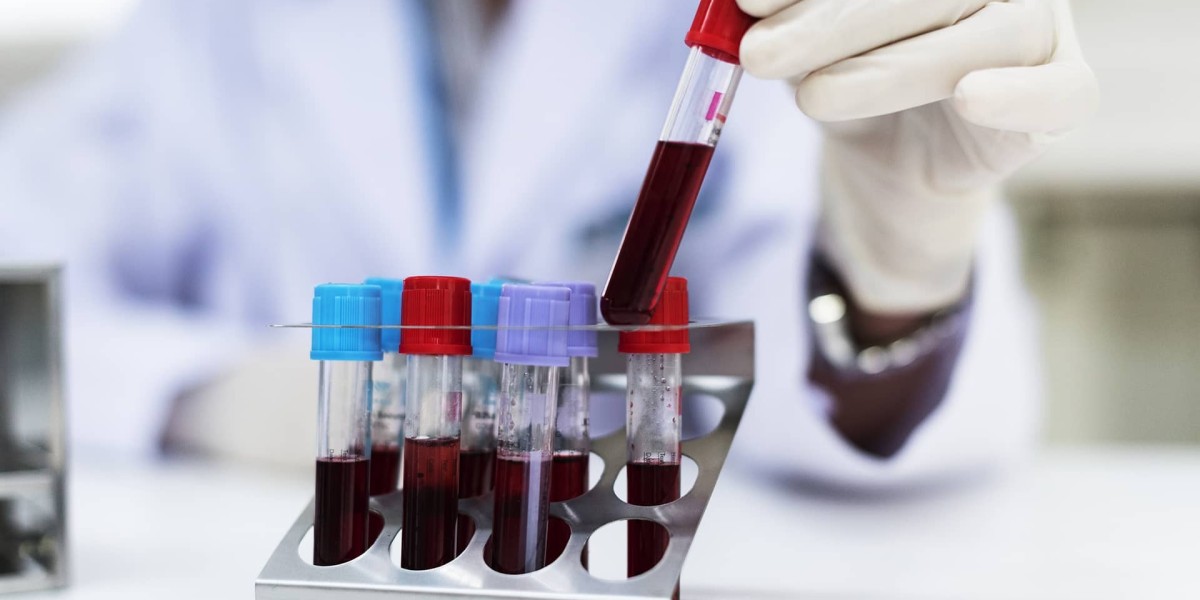 Do You Need a Doctor’s Prescription for a Chlamydia Test?