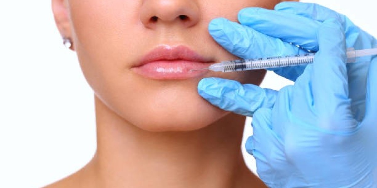 Lip Filler Injections Explained for First-Time Users
