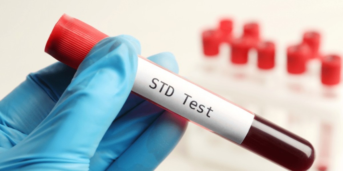 Stay Safe and Confident with Accurate STD Test