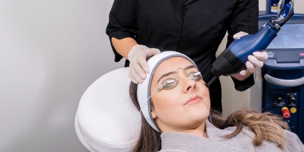 Fractional CO2 Laser Treatment Cost for Facial Redness: Is It Effective?