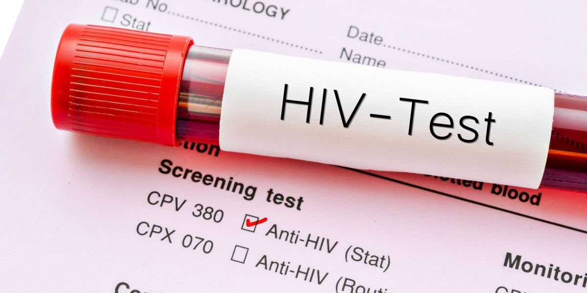 Early Detection Through HIV Test: Why Timing Is Critical