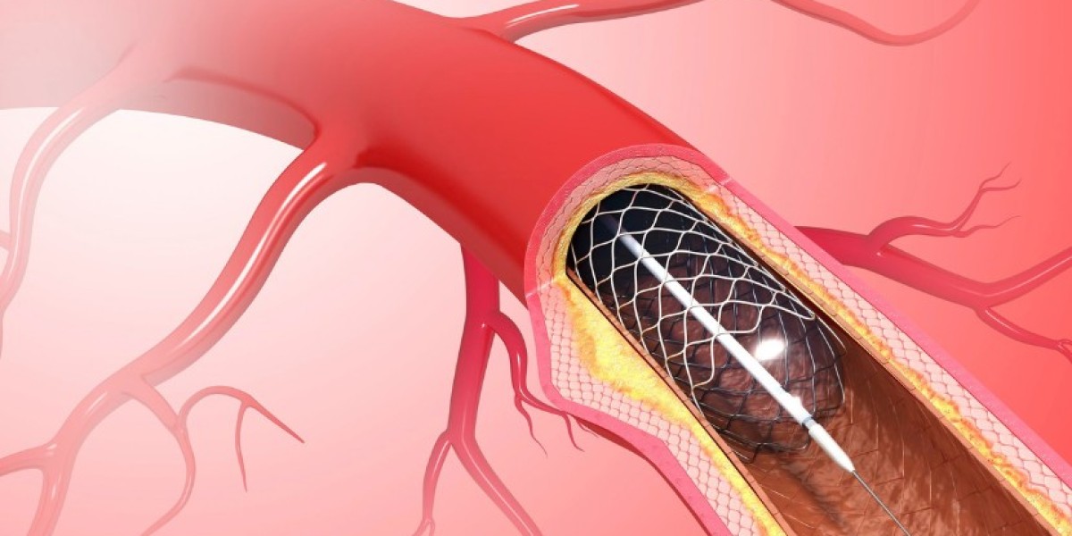 Vascular Stents Market Size | 2035