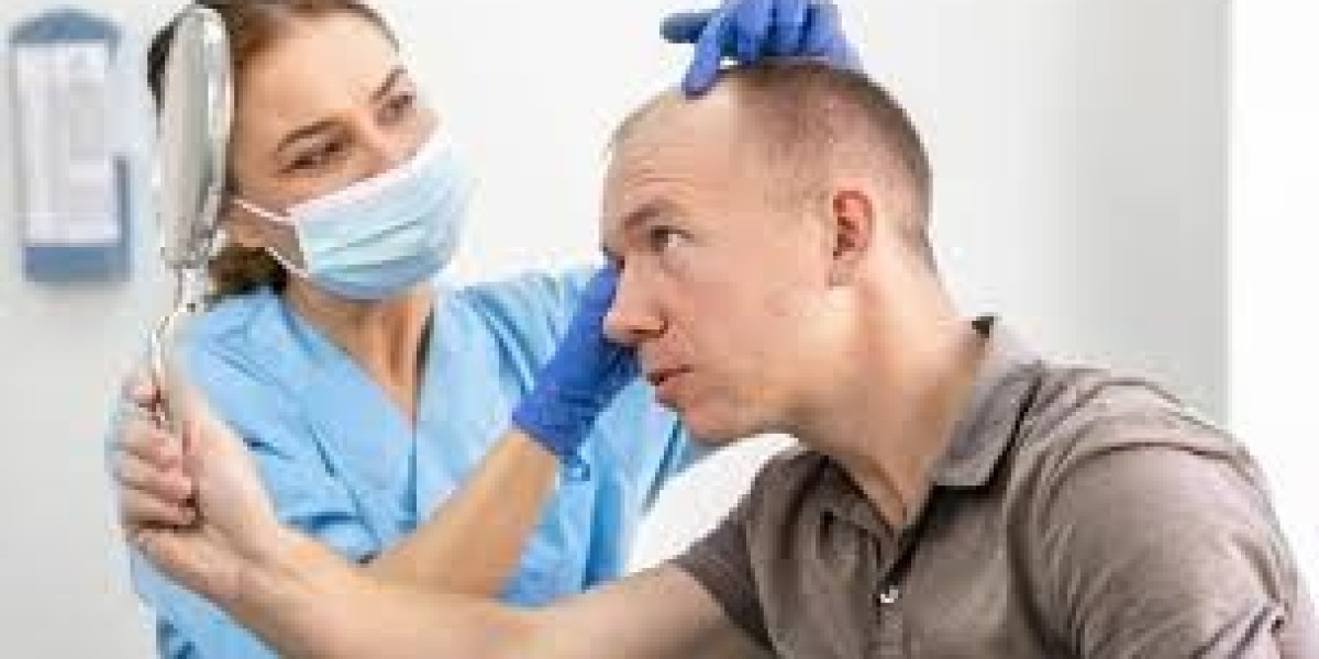 Best Hair Transplant Treatment in Lahore – Everything You Need to Know